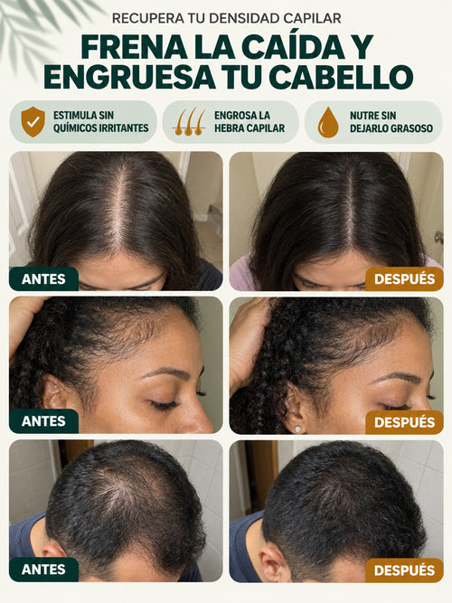 BatanActive™: Frena la caída y engrosa tu cabello.